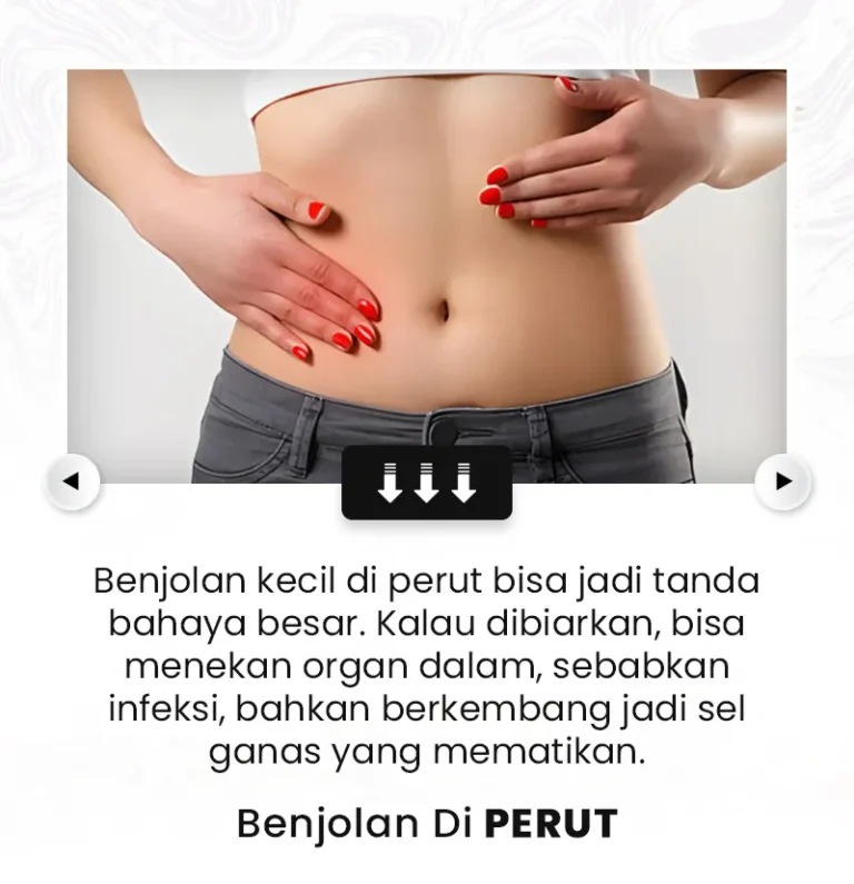 benjolan.webp